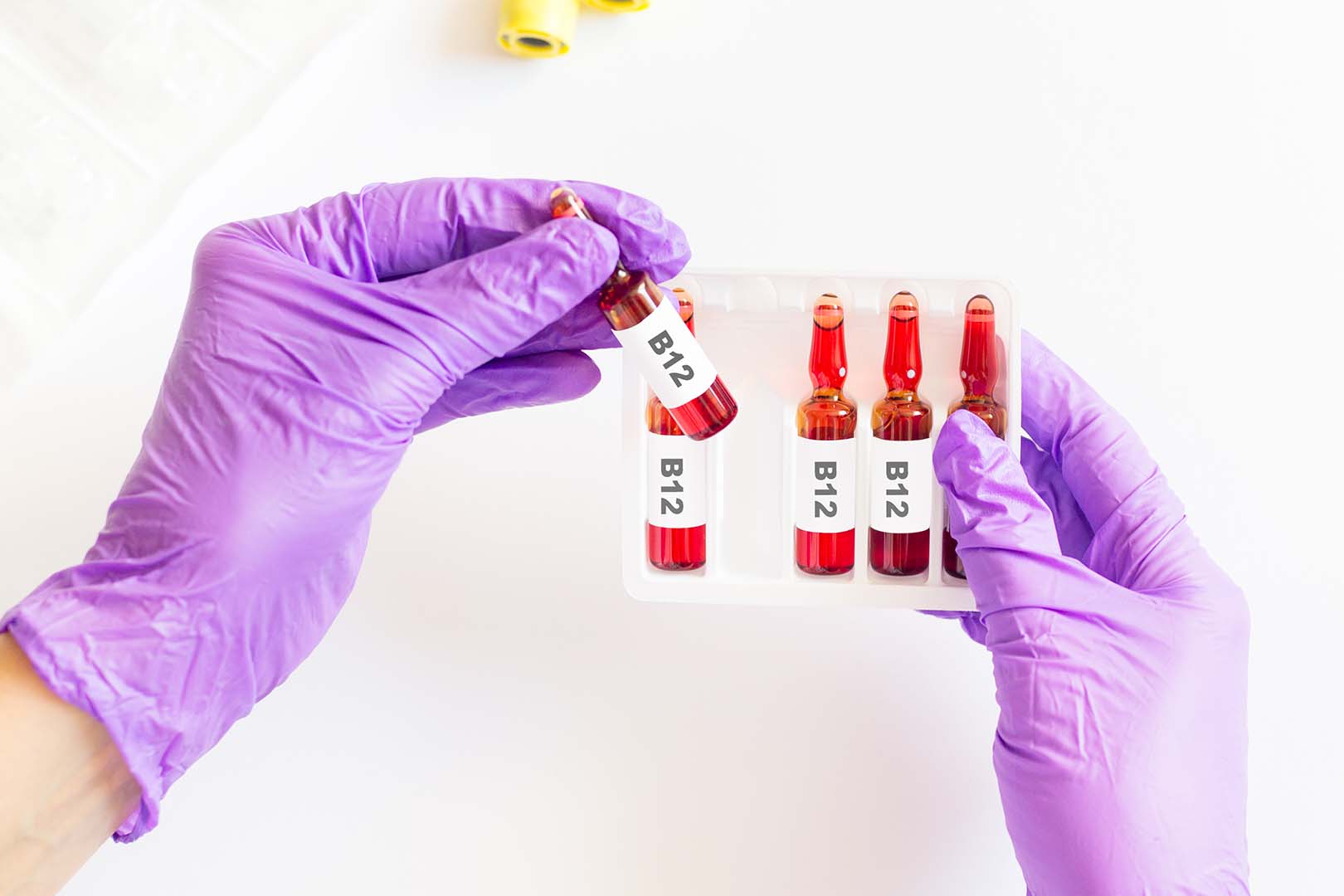 Panduan Teknis Profesional: Prosedur Aman, Steril, dan Standar Medis Suntik Vitamin B12 di Layanan Homecare